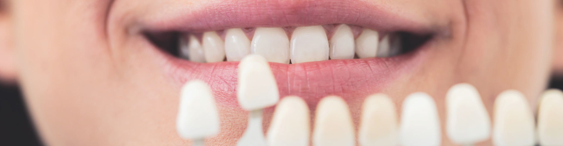 A patient smiling while the dentist holds veneer samples in front of their teeth.